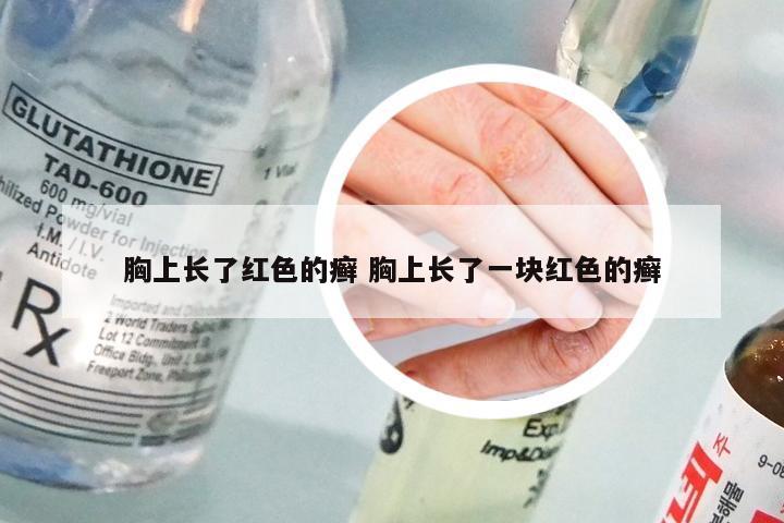 胸上长了红色的癣 胸上长了一块红色的癣