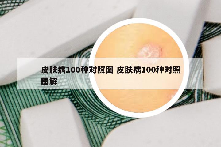 皮肤病100种对照图 皮肤病100种对照图解