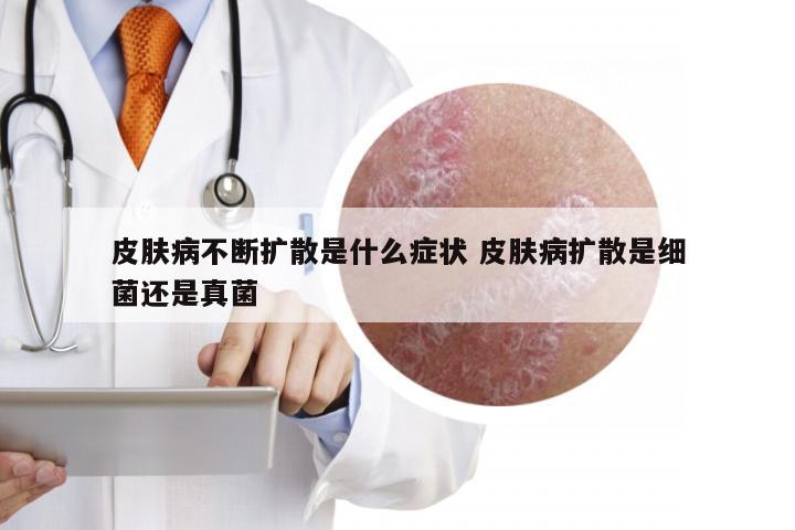 皮肤病不断扩散是什么症状 皮肤病扩散是细菌还是真菌