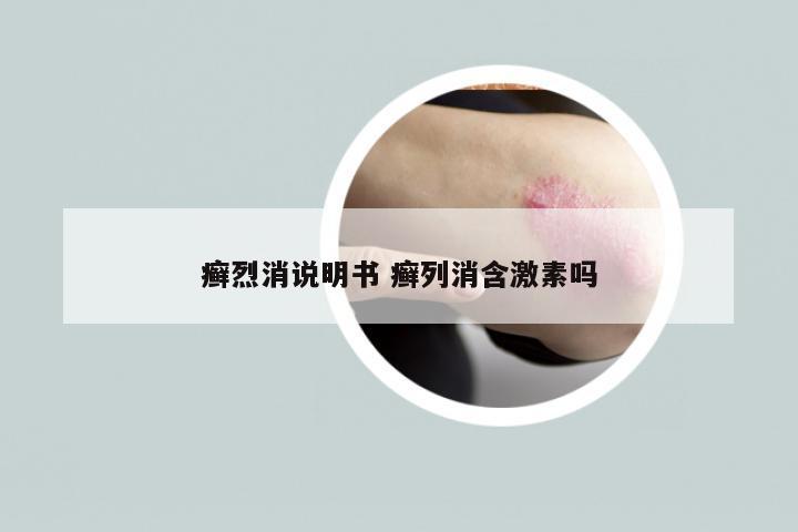 癣烈消说明书 癣列消含激素吗