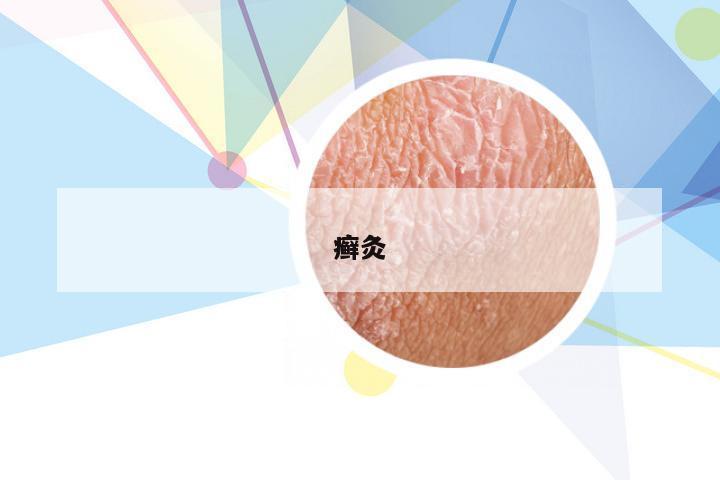 癣灸