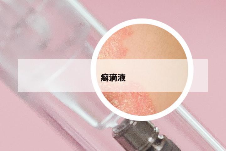癣滴液