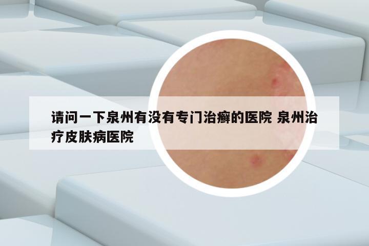 请问一下泉州有没有专门治癣的医院 泉州治疗皮肤病医院