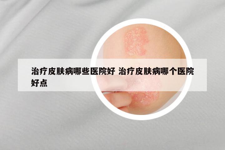 治疗皮肤病哪些医院好 治疗皮肤病哪个医院好点