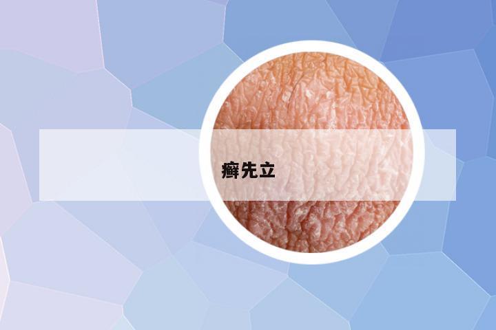 癣先立