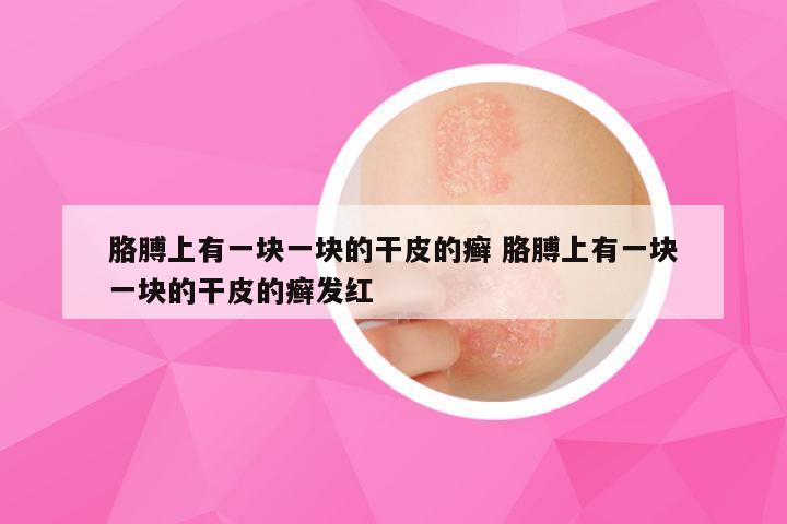 胳膊上有一块一块的干皮的癣 胳膊上有一块一块的干皮的癣发红