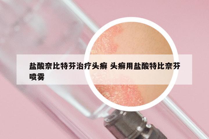 盐酸奈比特芬治疗头癣 头癣用盐酸特比奈芬喷雾