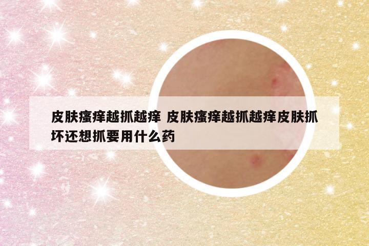 皮肤瘙痒越抓越痒 皮肤瘙痒越抓越痒皮肤抓坏还想抓要用什么药