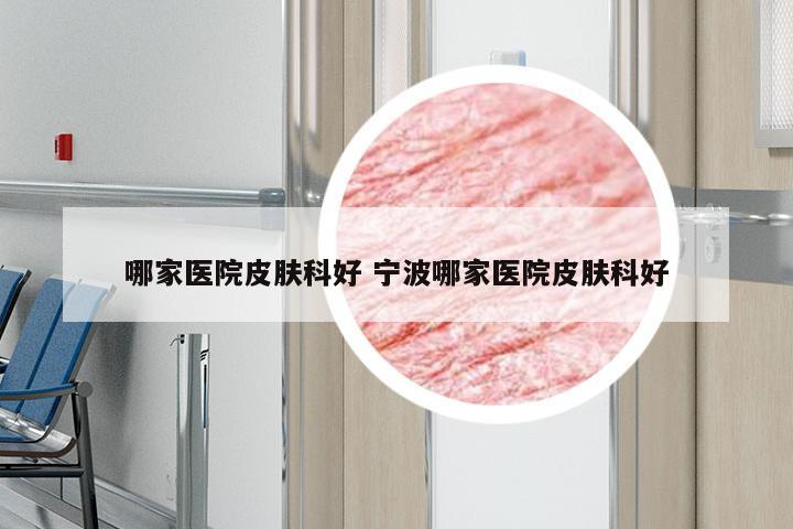 哪家医院皮肤科好 宁波哪家医院皮肤科好