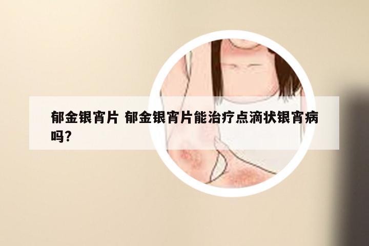 郁金银宵片 郁金银宵片能治疗点滴状银宵病吗?
