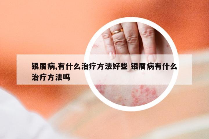银屑病,有什么治疗方法好些 银屑病有什么治疗方法吗