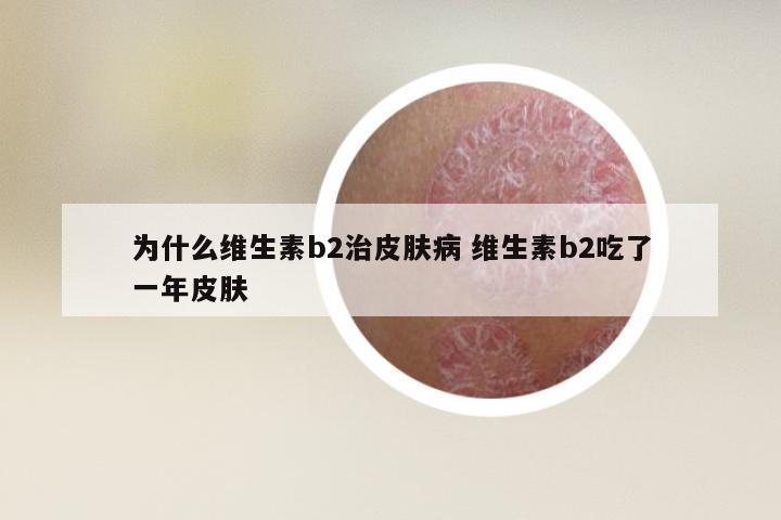 为什么维生素b2治皮肤病 维生素b2吃了一年皮肤