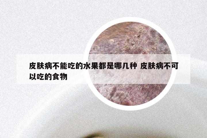 皮肤病不能吃的水果都是哪几种 皮肤病不可以吃的食物