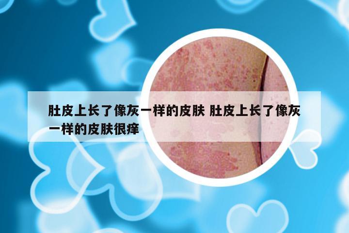 肚皮上长了像灰一样的皮肤 肚皮上长了像灰一样的皮肤很痒