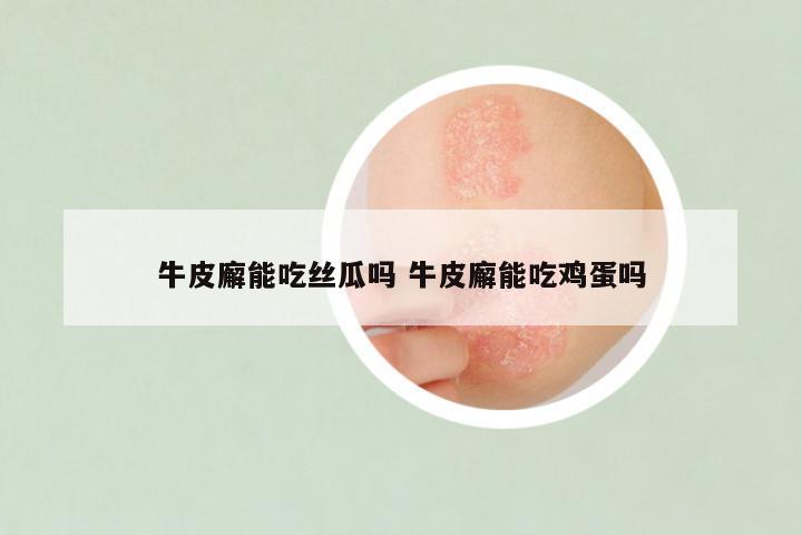 牛皮廨能吃丝瓜吗 牛皮廨能吃鸡蛋吗