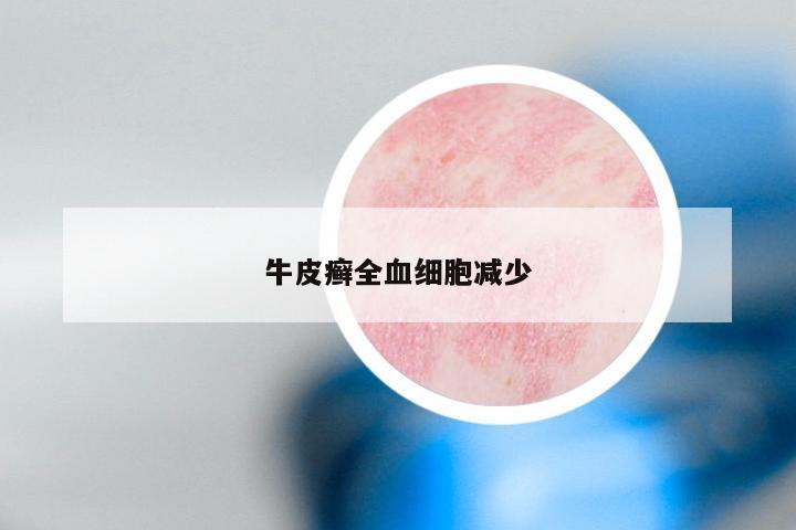 牛皮癣全血细胞减少