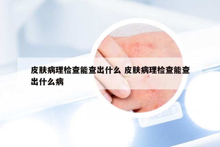 皮肤病理检查能查出什么 皮肤病理检查能查出什么病