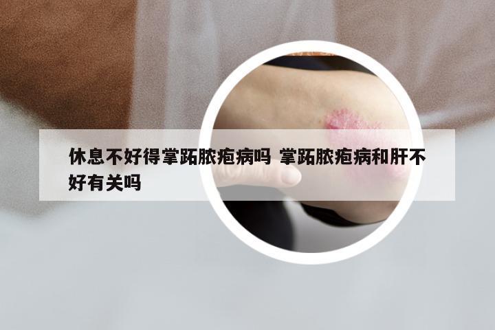 休息不好得掌跖脓疱病吗 掌跖脓疱病和肝不好有关吗