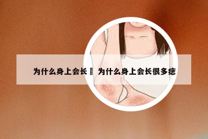为什么身上会长廯 为什么身上会长很多痣