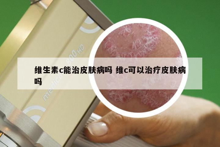 维生素c能治皮肤病吗 维c可以治疗皮肤病吗