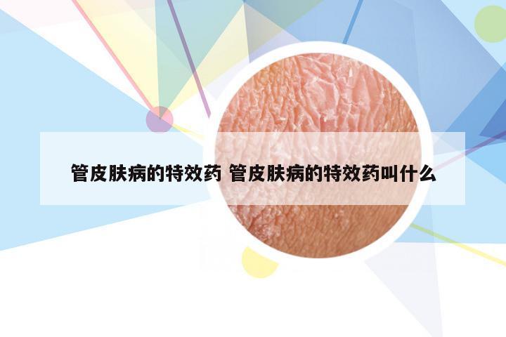 管皮肤病的特效药 管皮肤病的特效药叫什么