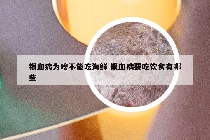 银血病为啥不能吃海鲜 银血病要吃饮食有哪些