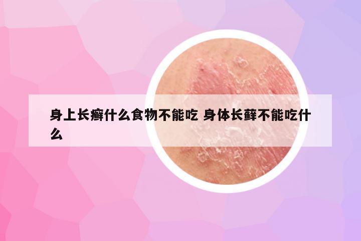 身上长癣什么食物不能吃 身体长藓不能吃什么