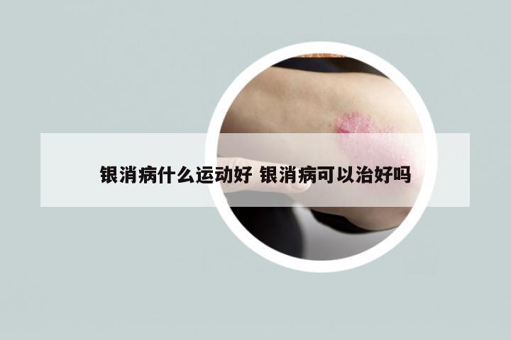 银消病什么运动好 银消病可以治好吗