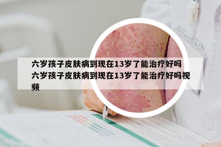 六岁孩子皮肤病到现在13岁了能治疗好吗 六岁孩子皮肤病到现在13岁了能治疗好吗视频