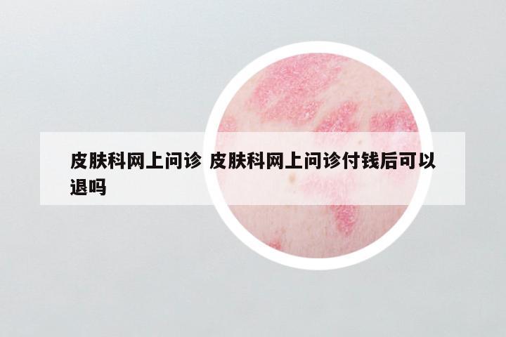 皮肤科网上问诊 皮肤科网上问诊付钱后可以退吗