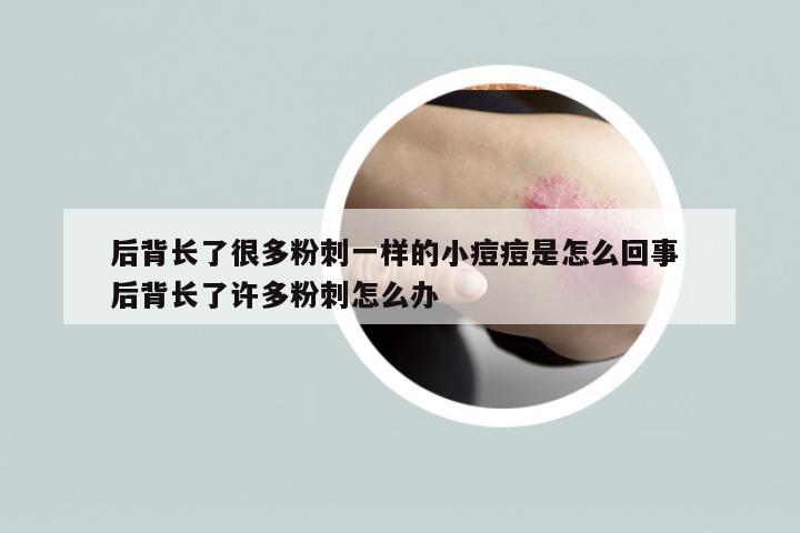 后背长了很多粉刺一样的小痘痘是怎么回事 后背长了许多粉刺怎么办