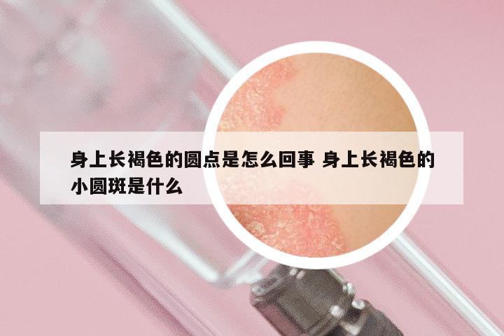 身上长褐色的圆点是怎么回事 身上长褐色的小圆斑是什么