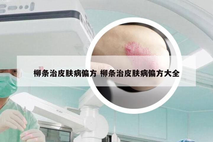 柳条治皮肤病偏方 柳条治皮肤病偏方大全