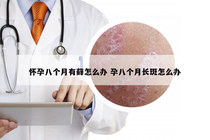 怀孕八个月有藓怎么办 孕八个月长斑怎么办