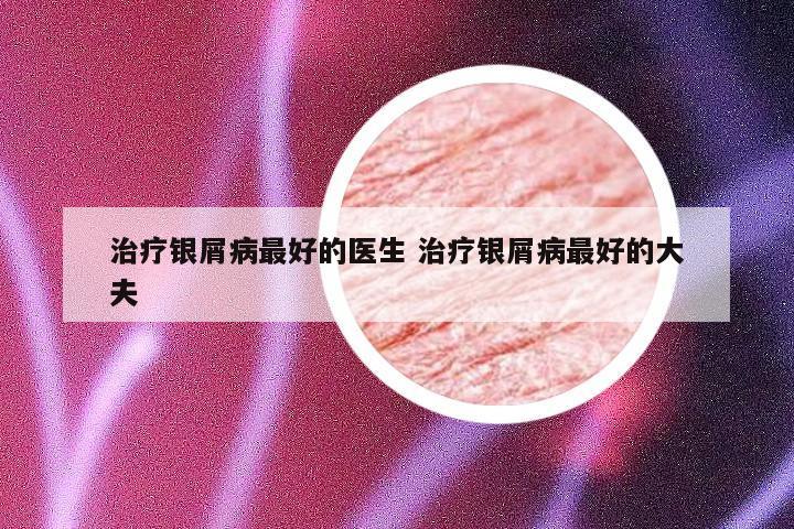 治疗银屑病最好的医生 治疗银屑病最好的大夫