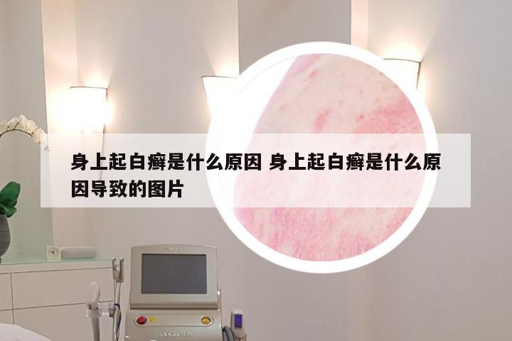 身上起白癣是什么原因 身上起白癣是什么原因导致的图片