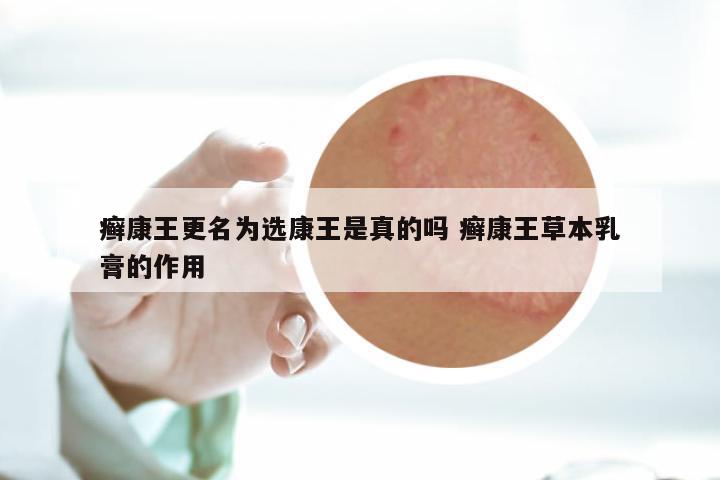 癣康王更名为选康王是真的吗 癣康王草本乳膏的作用