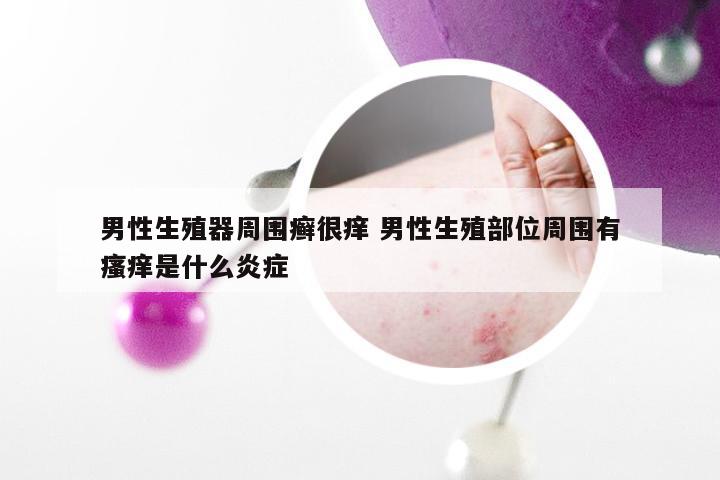 男性生殖器周围癣很痒 男性生殖部位周围有瘙痒是什么炎症