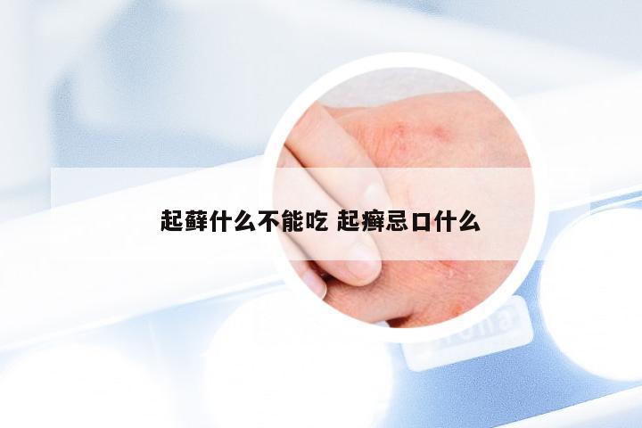 起藓什么不能吃 起癣忌口什么