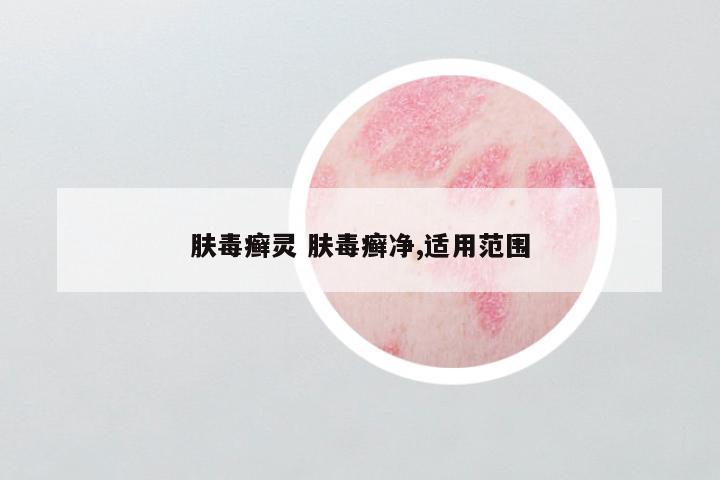 肤毒癣灵 肤毒癣净,适用范围