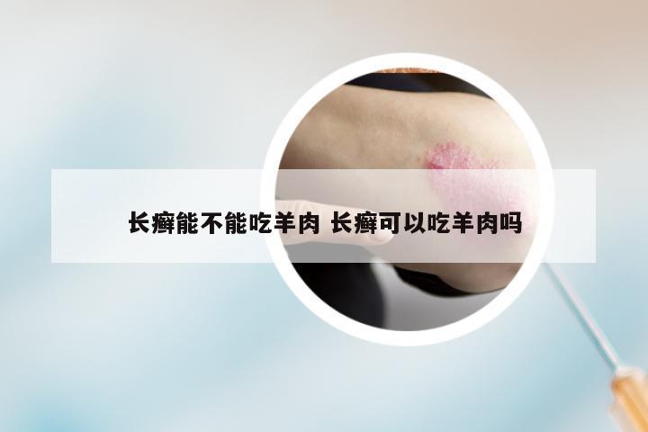 长癣能不能吃羊肉 长癣可以吃羊肉吗