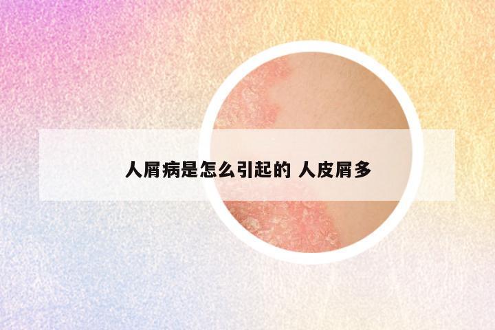 人屑病是怎么引起的 人皮屑多