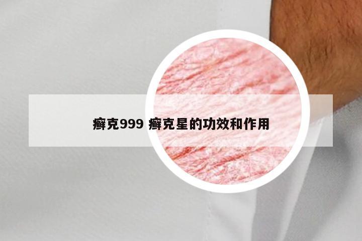 癣克999 癣克星的功效和作用