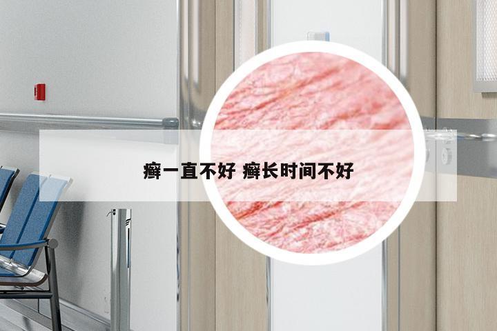 癣一直不好 癣长时间不好