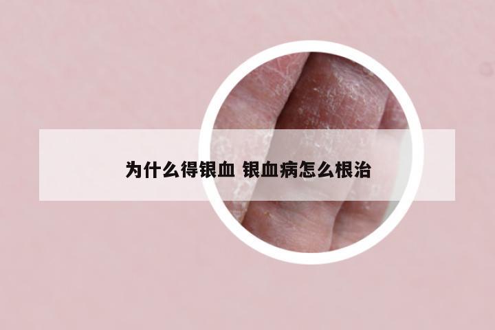 为什么得银血 银血病怎么根治