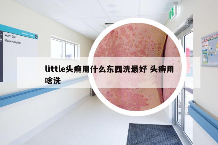 little头癣用什么东西洗最好 头癣用啥洗