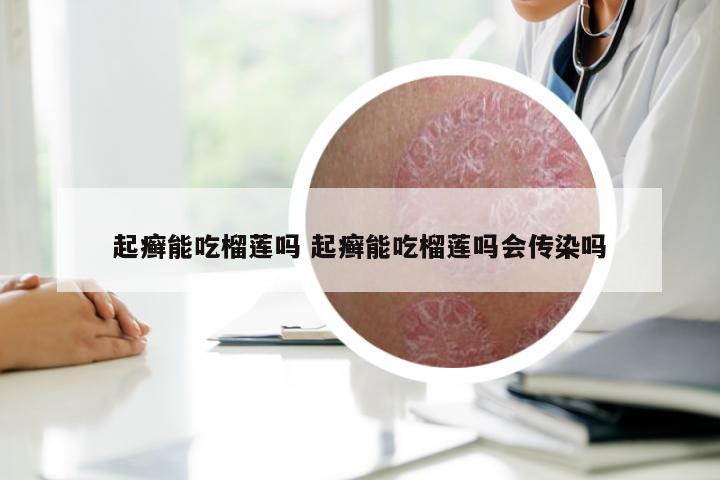 起癣能吃榴莲吗 起癣能吃榴莲吗会传染吗