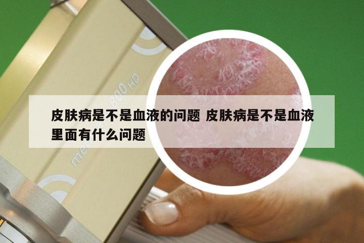 皮肤病是不是血液的问题 皮肤病是不是血液里面有什么问题