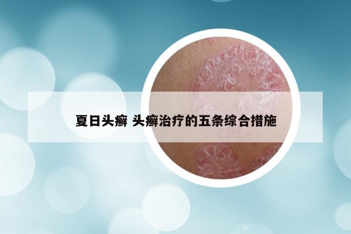 夏日头癣 头癣治疗的五条综合措施