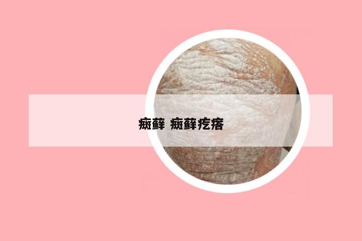癍藓 癍藓疙瘩